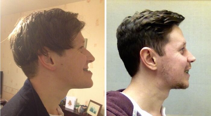 90 Mildly Interesting Before-And-After Photos That Show Just How Much Things Can Change