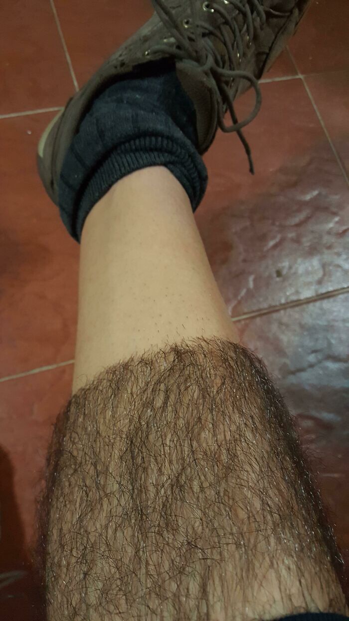 90 Mildly Interesting Before-And-After Photos That Show Just How Much Things Can Change