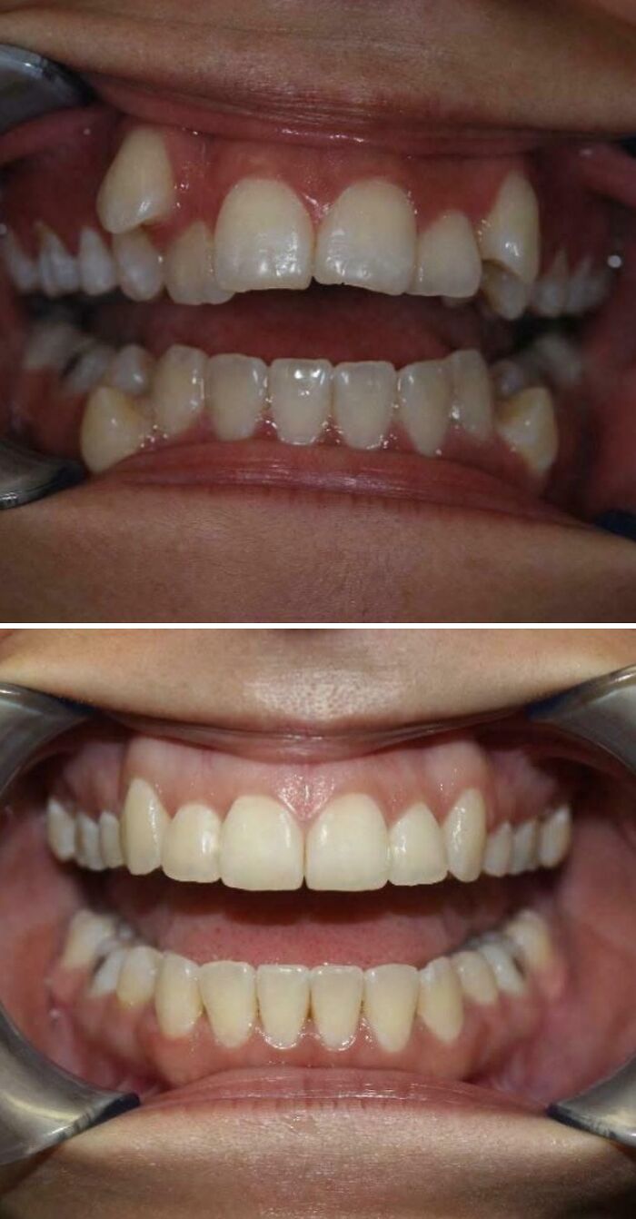 90 Mildly Interesting Before-And-After Photos That Show Just How Much Things Can Change