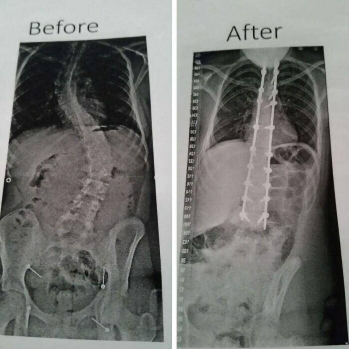 90 Mildly Interesting Before-And-After Photos That Show Just How Much Things Can Change