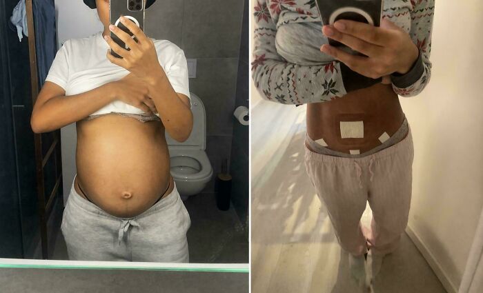 90 Mildly Interesting Before-And-After Photos That Show Just How Much Things Can Change