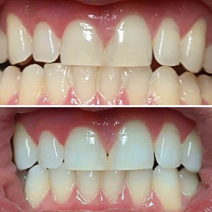 90 Mildly Interesting Before-And-After Photos That Show Just How Much Things Can Change