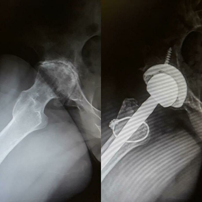 90 Mildly Interesting Before-And-After Photos That Show Just How Much Things Can Change