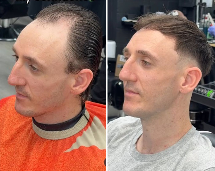 26 Drastic Men’s Hair And Beard Before-And-After Pics Shared By Barber Emiliano Familia