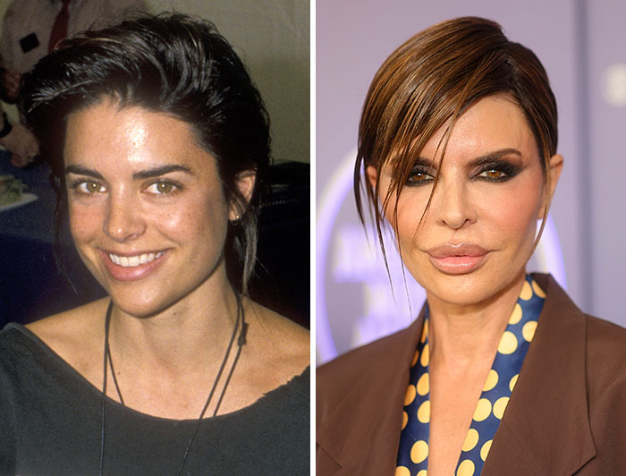 15 Pre-Plastic Surgery Photos Of Celebrities That Are Hard To Process