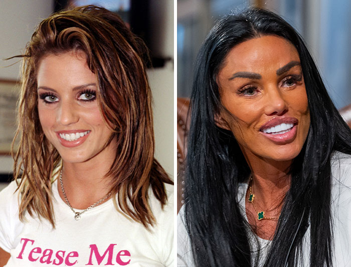 15 Pre-Plastic Surgery Photos Of Celebrities That Are Hard To Process