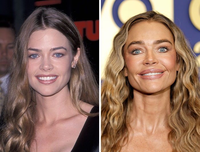 15 Pre-Plastic Surgery Photos Of Celebrities That Are Hard To Process