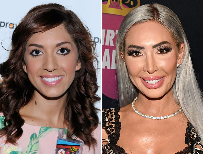 15 Pre-Plastic Surgery Photos Of Celebrities That Are Hard To Process