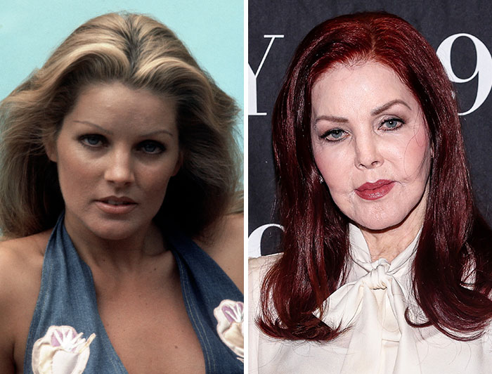 15 Pre-Plastic Surgery Photos Of Celebrities That Are Hard To Process
