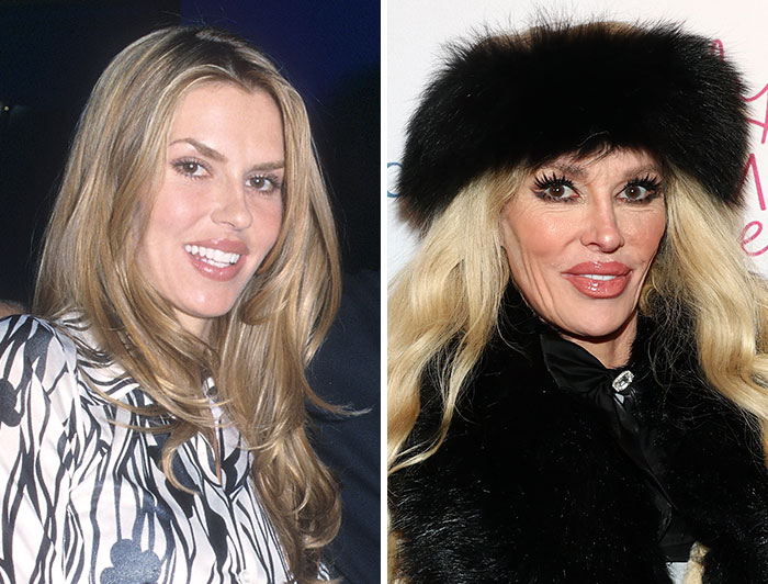 15 Pre-Plastic Surgery Photos Of Celebrities That Are Hard To Process
