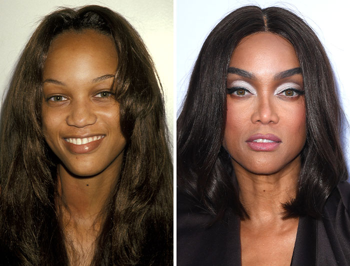 15 Pre-Plastic Surgery Photos Of Celebrities That Are Hard To Process