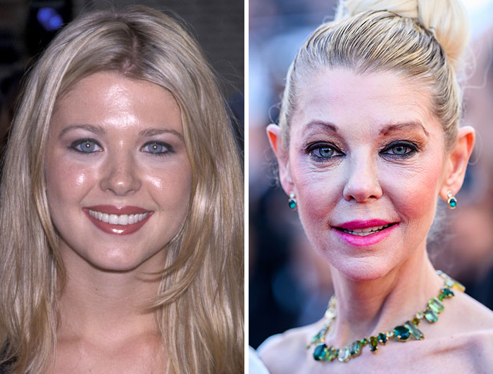 15 Pre-Plastic Surgery Photos Of Celebrities That Are Hard To Process