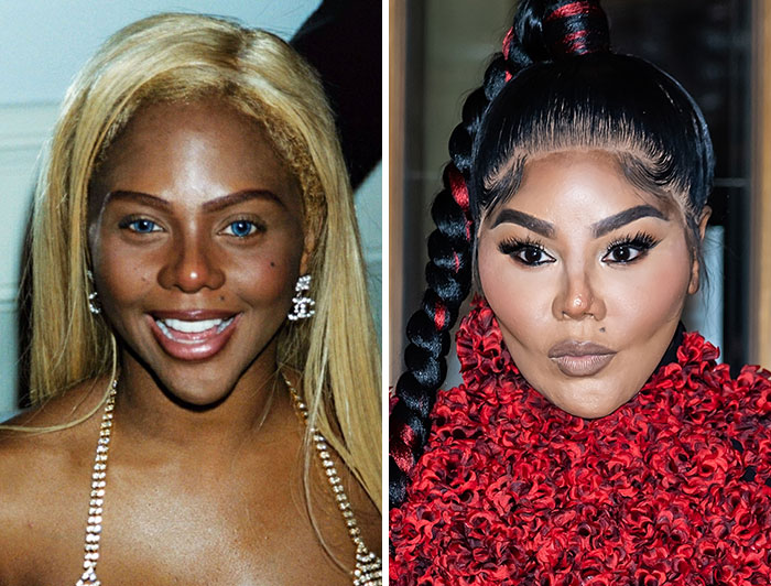 15 Pre-Plastic Surgery Photos Of Celebrities That Are Hard To Process