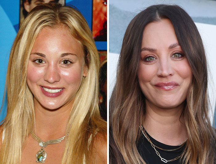 15 Pre-Plastic Surgery Photos Of Celebrities That Are Hard To Process