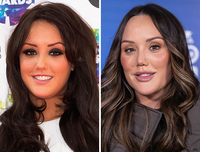 15 Pre-Plastic Surgery Photos Of Celebrities That Are Hard To Process