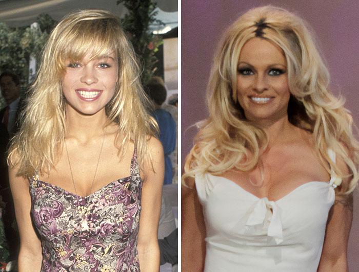 15 Pre-Plastic Surgery Photos Of Celebrities That Are Hard To Process