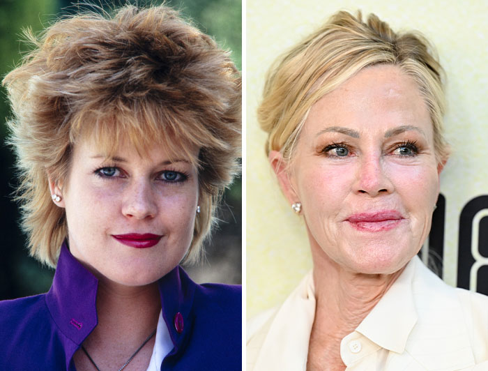 15 Pre-Plastic Surgery Photos Of Celebrities That Are Hard To Process