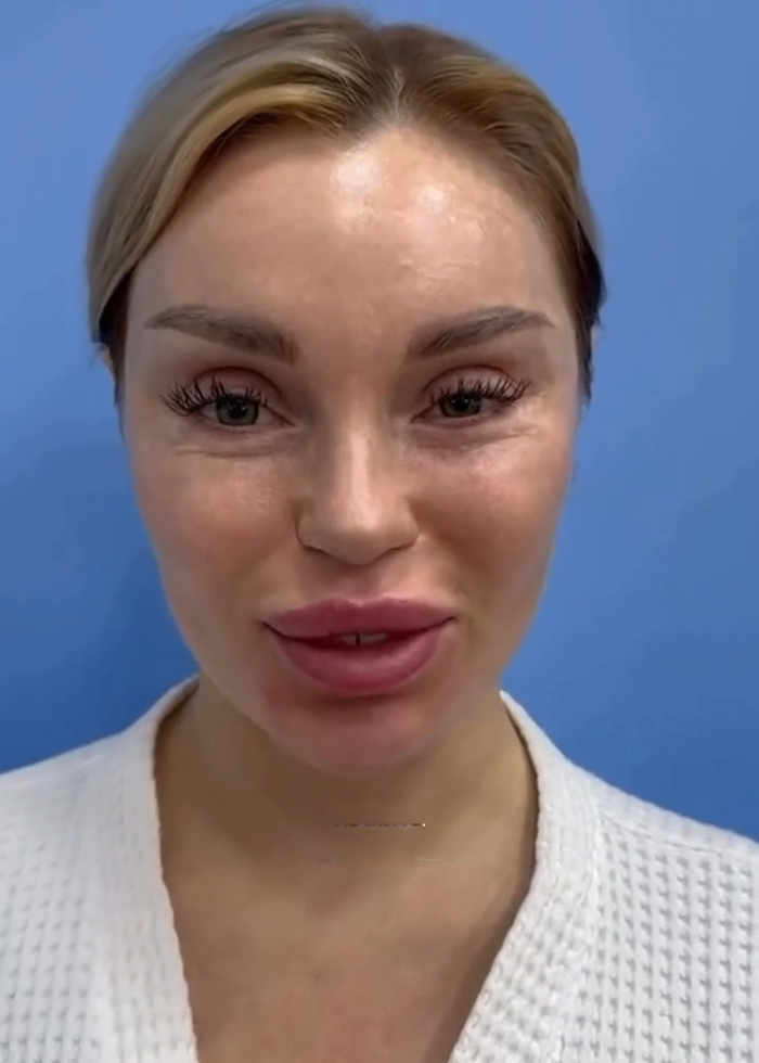 Woman’s Post-Plastic Surgery Photos Divide The Internet As She And Her Surgeon Celebrate The Results Woman’s Post-Plastic Surgery Photos Divide The Internet As She And Her Surgeon Celebrate The Results