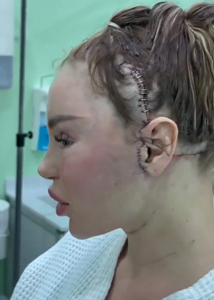 Woman’s Post-Plastic Surgery Photos Divide The Internet As She And Her Surgeon Celebrate The Results Woman’s Post-Plastic Surgery Photos Divide The Internet As She And Her Surgeon Celebrate The Results
