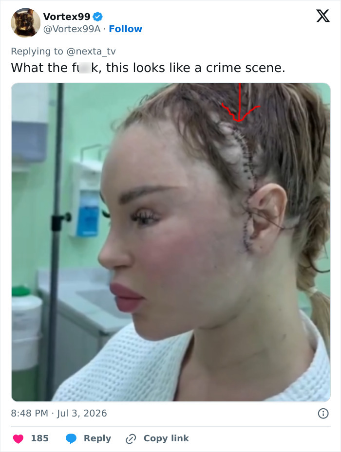 Woman’s Post-Plastic Surgery Photos Divide The Internet As She And Her Surgeon Celebrate The Results Woman’s Post-Plastic Surgery Photos Divide The Internet As She And Her Surgeon Celebrate The Results