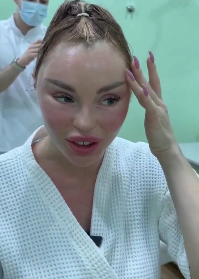 Woman’s Post-Plastic Surgery Photos Divide The Internet As She And Her Surgeon Celebrate The Results Woman’s Post-Plastic Surgery Photos Divide The Internet As She And Her Surgeon Celebrate The Results