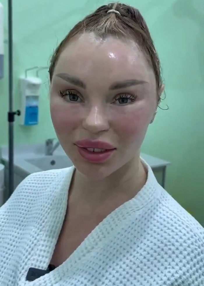 Woman’s Post-Plastic Surgery Photos Divide The Internet As She And Her Surgeon Celebrate The Results Woman’s Post-Plastic Surgery Photos Divide The Internet As She And Her Surgeon Celebrate The Results