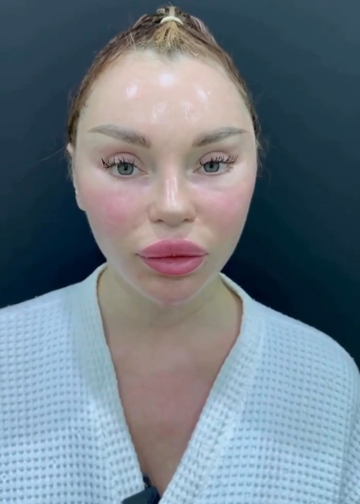 Woman’s Post-Plastic Surgery Photos Divide The Internet As She And Her Surgeon Celebrate The Results Woman’s Post-Plastic Surgery Photos Divide The Internet As She And Her Surgeon Celebrate The Results