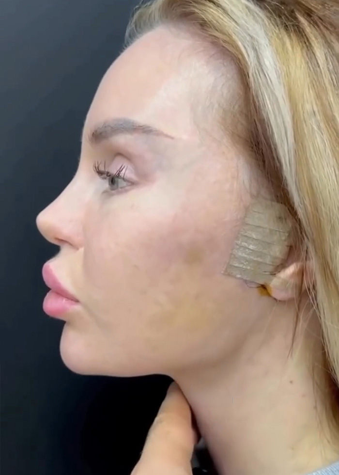 Woman’s Post-Plastic Surgery Photos Divide The Internet As She And Her Surgeon Celebrate The Results Woman’s Post-Plastic Surgery Photos Divide The Internet As She And Her Surgeon Celebrate The Results