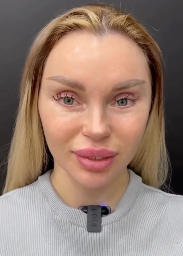 Woman’s Post-Plastic Surgery Photos Divide The Internet As She And Her Surgeon Celebrate The Results Woman’s Post-Plastic Surgery Photos Divide The Internet As She And Her Surgeon Celebrate The Results