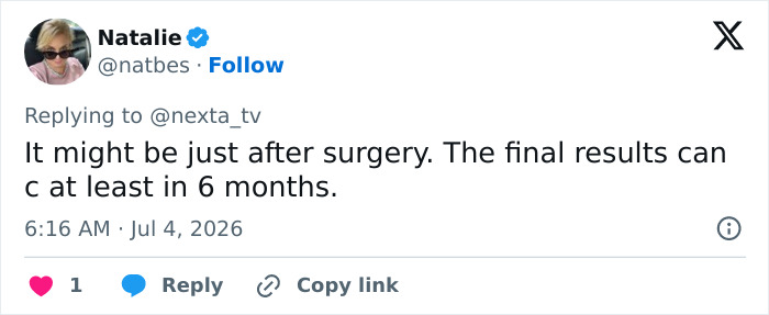 Woman’s Post-Plastic Surgery Photos Divide The Internet As She And Her Surgeon Celebrate The Results Woman’s Post-Plastic Surgery Photos Divide The Internet As She And Her Surgeon Celebrate The Results