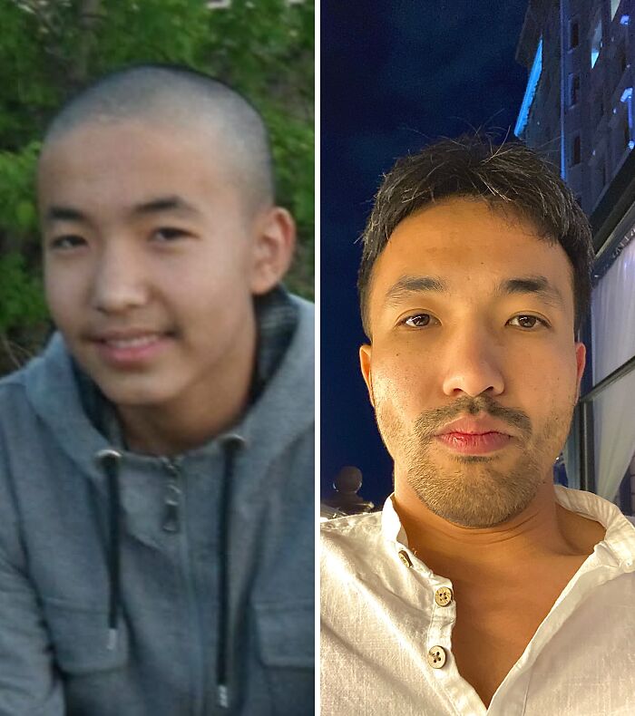 48 “Ugly Ducklings” Share The Incredible Transformations That Made Them Love Themselves