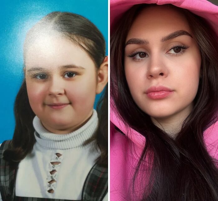 48 “Ugly Ducklings” Share The Incredible Transformations That Made Them Love Themselves
