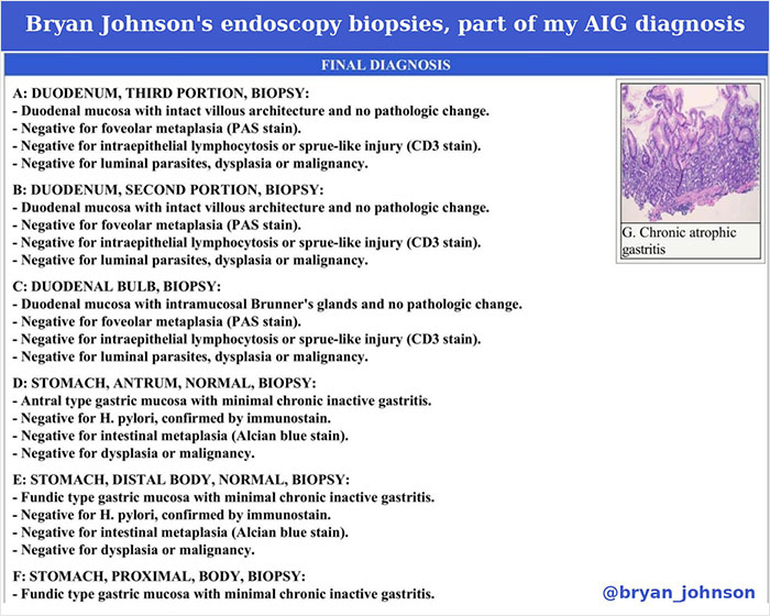 Biohacker Bryan Johnson Reveals Dreadful Diagnosis Despite Meticulous And Intense Health Regimen