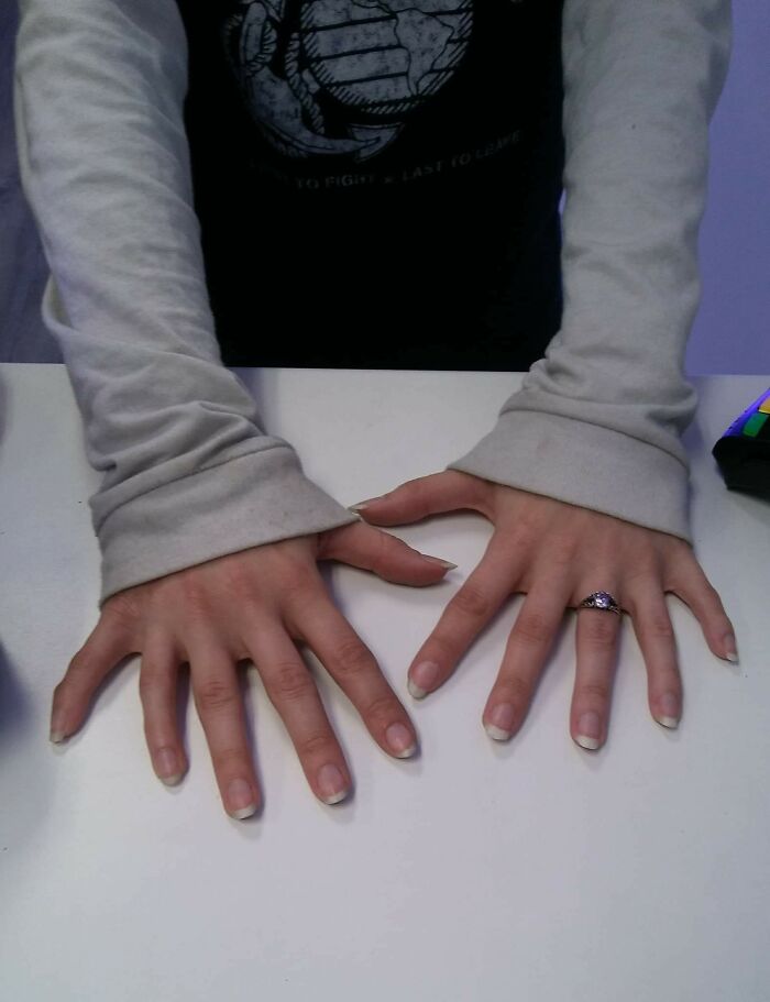 80 Photos Proving The Human Body Is As Strange As It Is Amazing 80 Photos Proving The Human Body Is As Strange As It Is Amazing