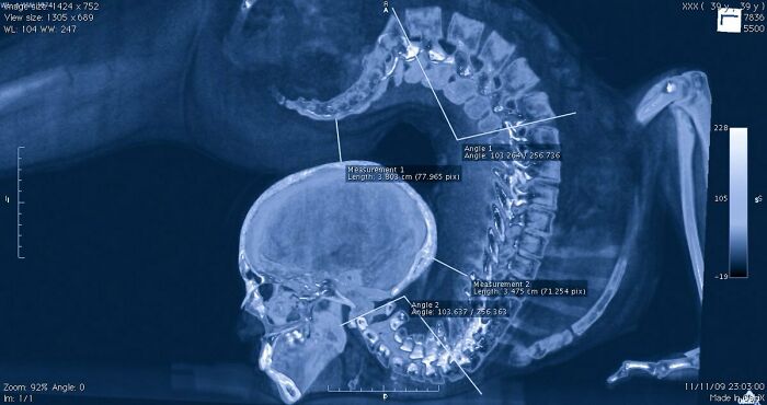 80 Photos Proving The Human Body Is As Strange As It Is Amazing 80 Photos Proving The Human Body Is As Strange As It Is Amazing