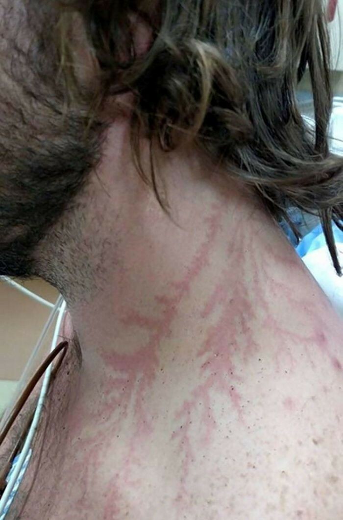 80 Photos Proving The Human Body Is As Strange As It Is Amazing 80 Photos Proving The Human Body Is As Strange As It Is Amazing