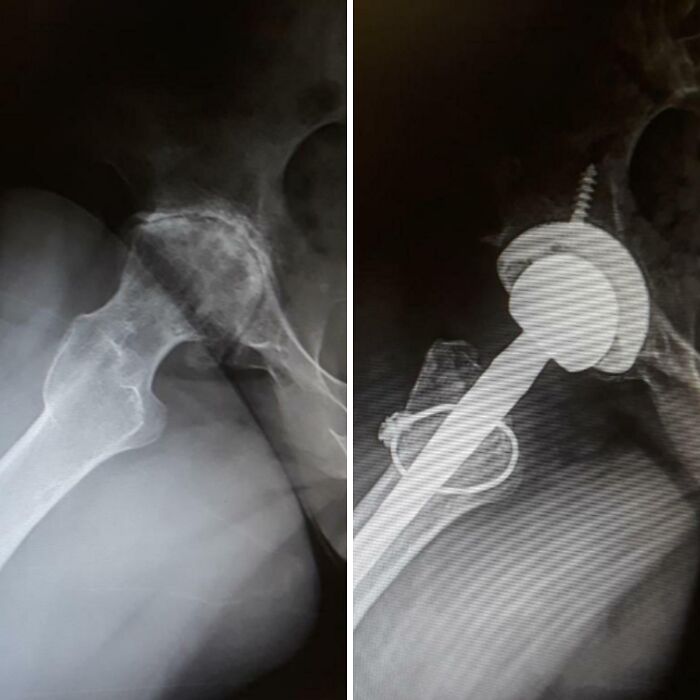 80 Photos Proving The Human Body Is As Strange As It Is Amazing 80 Photos Proving The Human Body Is As Strange As It Is Amazing