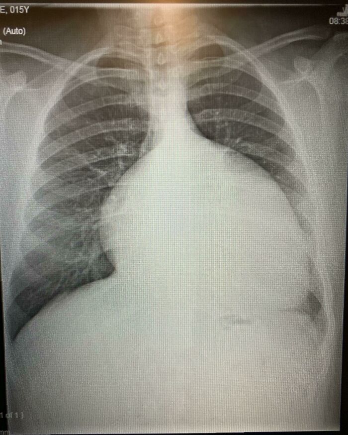 80 Photos Proving The Human Body Is As Strange As It Is Amazing 80 Photos Proving The Human Body Is As Strange As It Is Amazing
