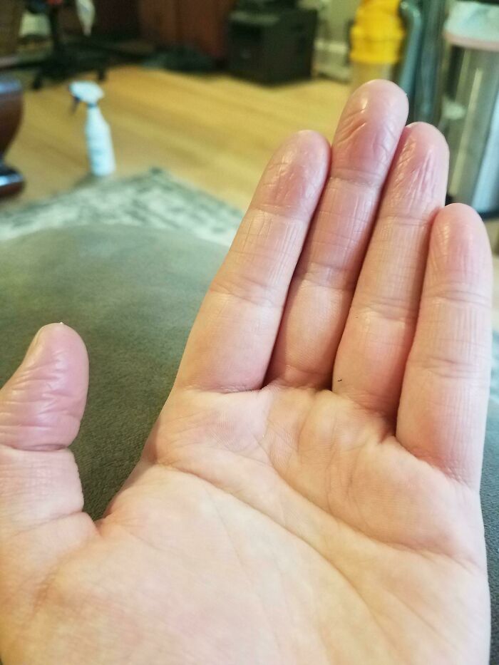 80 Photos Proving The Human Body Is As Strange As It Is Amazing 80 Photos Proving The Human Body Is As Strange As It Is Amazing
