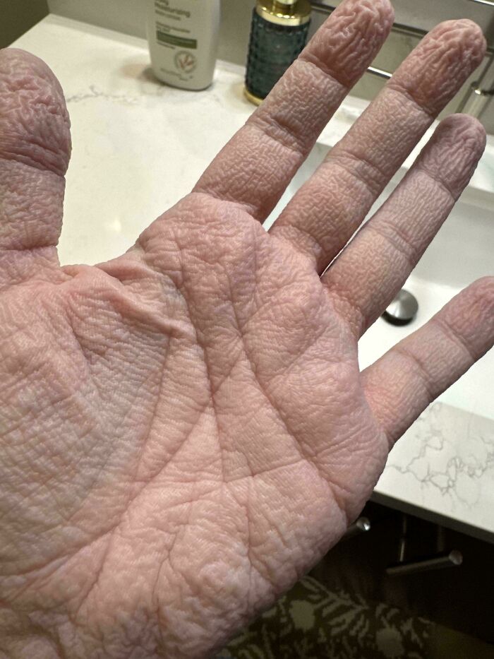 80 Photos Proving The Human Body Is As Strange As It Is Amazing 80 Photos Proving The Human Body Is As Strange As It Is Amazing
