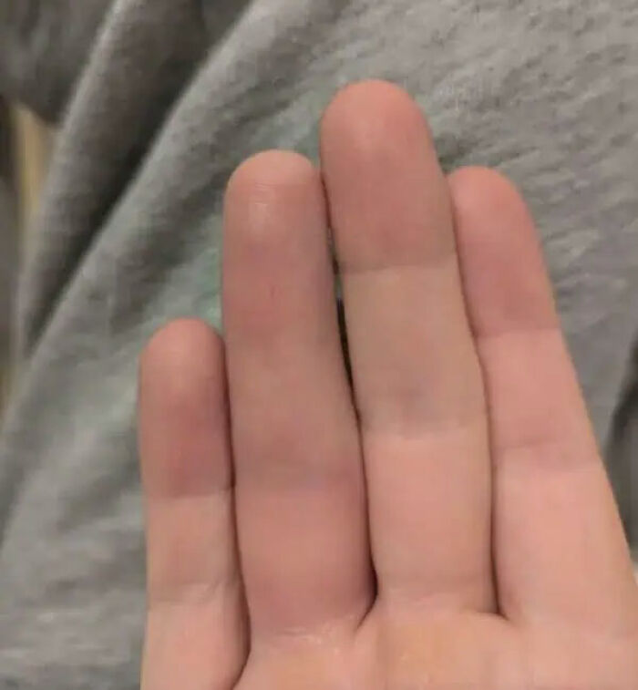 80 Photos Proving The Human Body Is As Strange As It Is Amazing 80 Photos Proving The Human Body Is As Strange As It Is Amazing