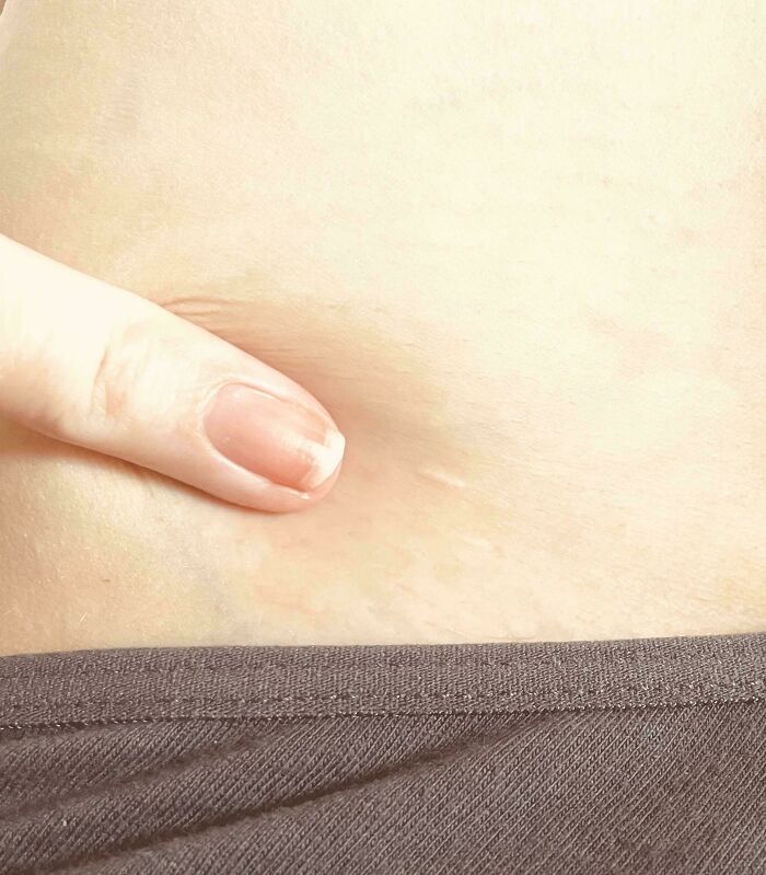 80 Photos Proving The Human Body Is As Strange As It Is Amazing 80 Photos Proving The Human Body Is As Strange As It Is Amazing
