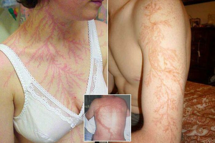 80 Photos Proving The Human Body Is As Strange As It Is Amazing 80 Photos Proving The Human Body Is As Strange As It Is Amazing