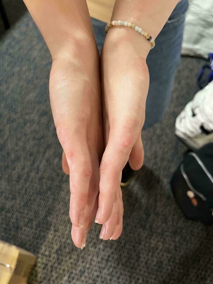 80 Photos Proving The Human Body Is As Strange As It Is Amazing 80 Photos Proving The Human Body Is As Strange As It Is Amazing