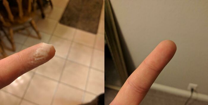 80 Photos Proving The Human Body Is As Strange As It Is Amazing 80 Photos Proving The Human Body Is As Strange As It Is Amazing