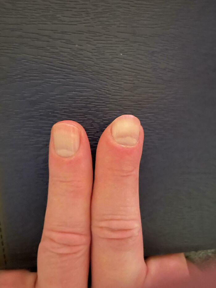 80 Photos Proving The Human Body Is As Strange As It Is Amazing 80 Photos Proving The Human Body Is As Strange As It Is Amazing