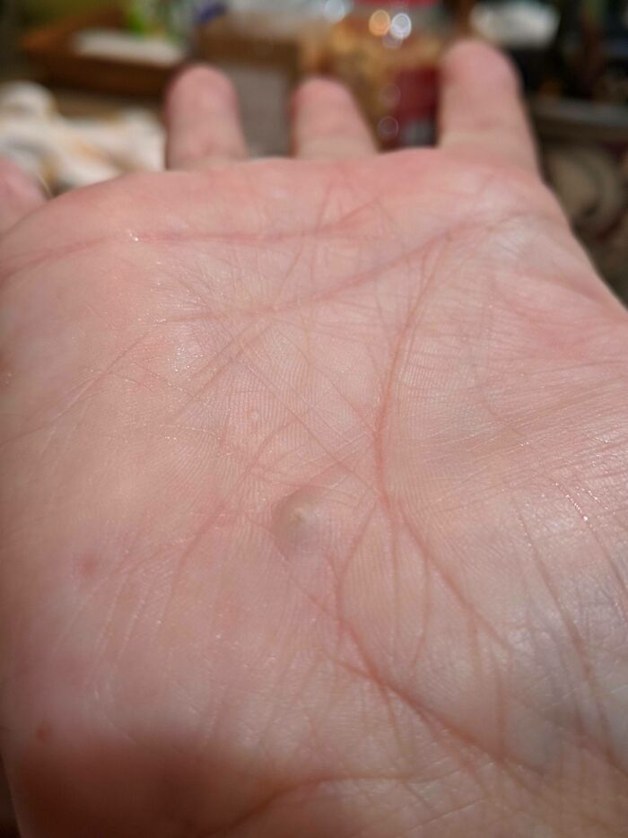 80 Photos Proving The Human Body Is As Strange As It Is Amazing 80 Photos Proving The Human Body Is As Strange As It Is Amazing