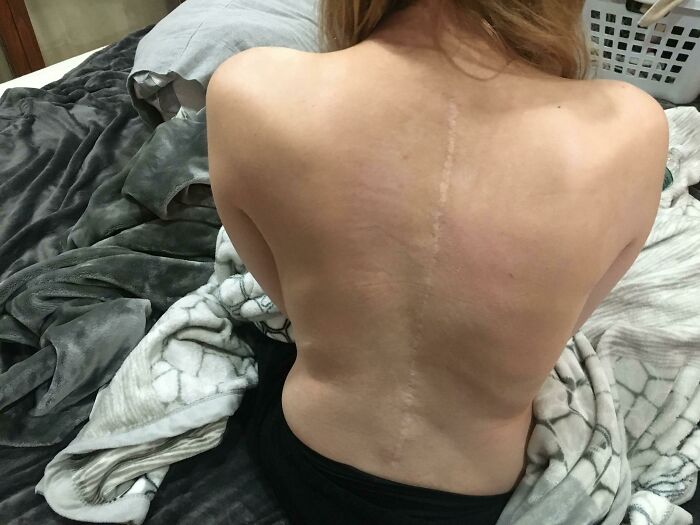 80 Photos Proving The Human Body Is As Strange As It Is Amazing 80 Photos Proving The Human Body Is As Strange As It Is Amazing