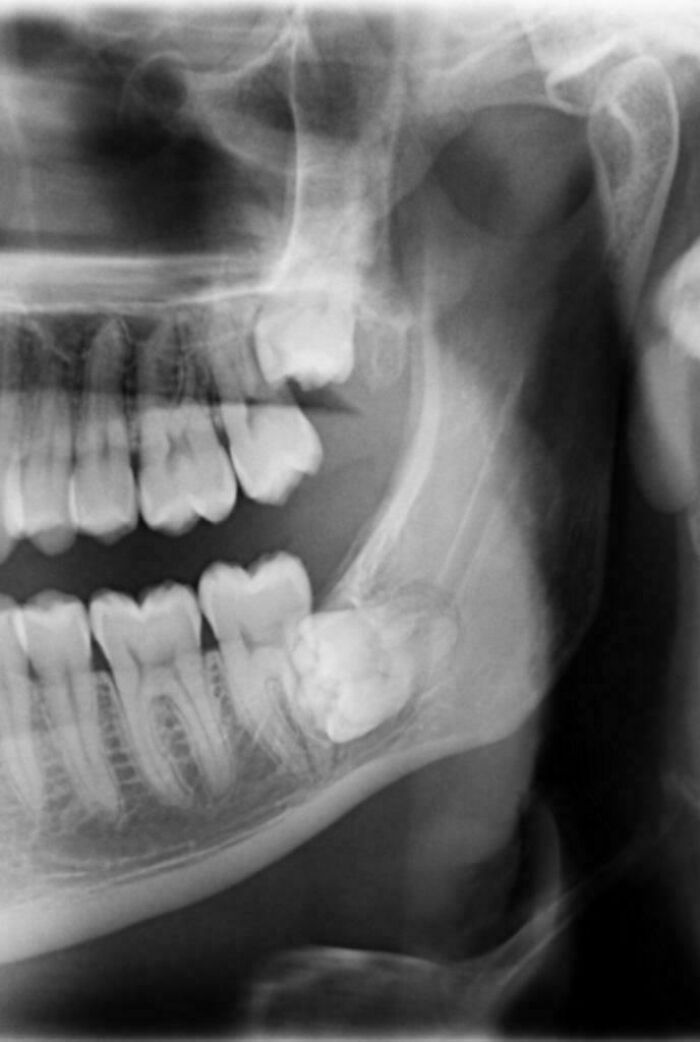 80 Photos Proving The Human Body Is As Strange As It Is Amazing 80 Photos Proving The Human Body Is As Strange As It Is Amazing