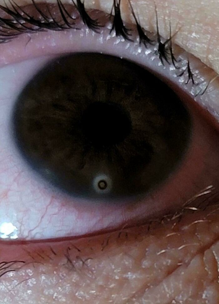 80 Photos Proving The Human Body Is As Strange As It Is Amazing 80 Photos Proving The Human Body Is As Strange As It Is Amazing